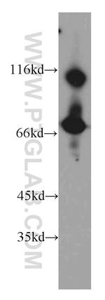 Transketolase Antibody in Western Blot (WB)