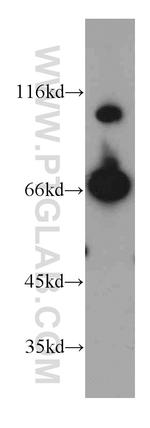 Transketolase Antibody in Western Blot (WB)