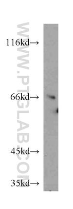 Transketolase Antibody in Western Blot (WB)