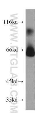 Transketolase Antibody in Western Blot (WB)