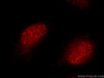 SYCE1 Antibody in Immunocytochemistry (ICC/IF)