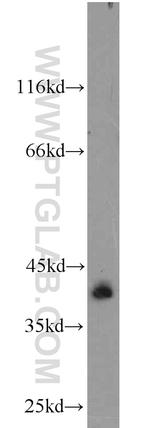 SYCE1 Antibody in Western Blot (WB)