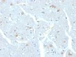 Ubiquitin-conjugating Enzyme E2C/UBCH10 Antibody in Immunohistochemistry (Paraffin) (IHC (P))