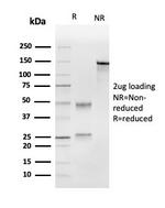 Ubiquitin-conjugating Enzyme E2C/UBCH10 Antibody in SDS-PAGE (SDS-PAGE)