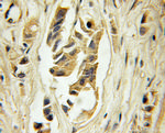 CA9 Antibody in Immunohistochemistry (Paraffin) (IHC (P))