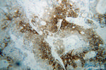 CA9 Antibody in Immunohistochemistry (Paraffin) (IHC (P))