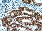 CA9 Antibody in Immunohistochemistry (Paraffin) (IHC (P))