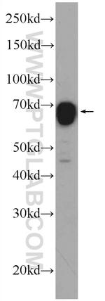 CA9 Antibody in Western Blot (WB)