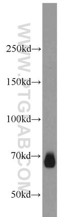 CA9 Antibody in Western Blot (WB)