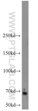 CA9 Antibody in Western Blot (WB)