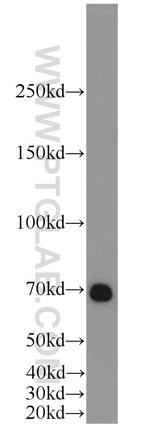 CA9 Antibody in Western Blot (WB)