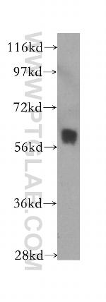 CA9 Antibody in Western Blot (WB)