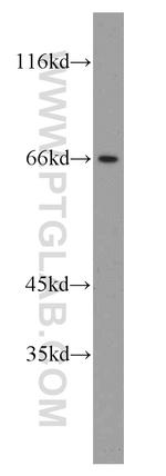 CA9 Antibody in Western Blot (WB)