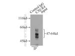 CXCR4 Antibody in Immunoprecipitation (IP)