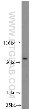 BORIS Antibody in Western Blot (WB)