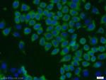 NME1 Antibody in Immunocytochemistry (ICC/IF)