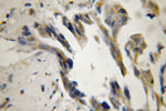 TID1 Antibody in Immunohistochemistry (Paraffin) (IHC (P))