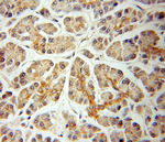 TID1 Antibody in Immunohistochemistry (Paraffin) (IHC (P))