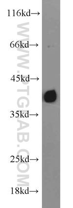 TID1 Antibody in Western Blot (WB)