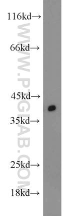 TID1 Antibody in Western Blot (WB)