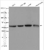 DNAJC7 Antibody in Western Blot (WB)