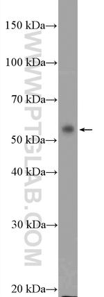 DNAJC7 Antibody in Western Blot (WB)