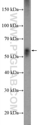 DNAJC7 Antibody in Western Blot (WB)