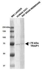 Trap1 Antibody in Western Blot (WB)