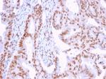 DMC1 Antibody in Immunohistochemistry (Paraffin) (IHC (P))