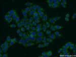 ABCD1 Antibody in Immunocytochemistry (ICC/IF)