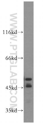 FKBP8 Antibody in Western Blot (WB)