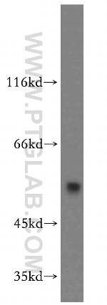 FKBP8 Antibody in Western Blot (WB)