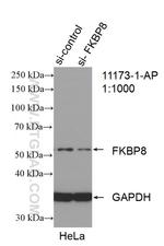 FKBP8 Antibody in Western Blot (WB)