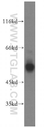 FKBP8 Antibody in Western Blot (WB)