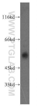 FKBP8 Antibody in Western Blot (WB)