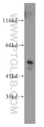 FKBP8 Antibody in Western Blot (WB)