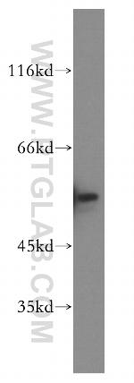 FKBP8 Antibody in Western Blot (WB)