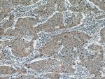 TIMM17A Antibody in Immunohistochemistry (Paraffin) (IHC (P))