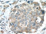 ILVBL Antibody in Immunohistochemistry (Paraffin) (IHC (P))