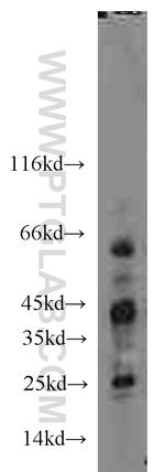 FLCN Antibody in Western Blot (WB)