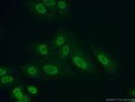 PRMT1 Antibody in Immunocytochemistry (ICC/IF)