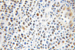 PRMT1 Antibody in Immunohistochemistry (Paraffin) (IHC (P))