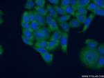RPLP0 Antibody in Immunocytochemistry (ICC/IF)