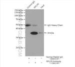RPLP0 Antibody in Immunoprecipitation (IP)