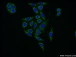 EIF2B3 Antibody in Immunocytochemistry (ICC/IF)