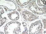 SERPINE2 Antibody in Immunohistochemistry (Paraffin) (IHC (P))