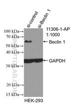 Beclin 1 Antibody in Western Blot (WB)