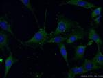 Beclin 1 Antibody in Immunocytochemistry (ICC/IF)