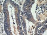 Beclin 1 Antibody in Immunohistochemistry (Paraffin) (IHC (P))