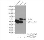 Beclin 1 Antibody in Immunoprecipitation (IP)